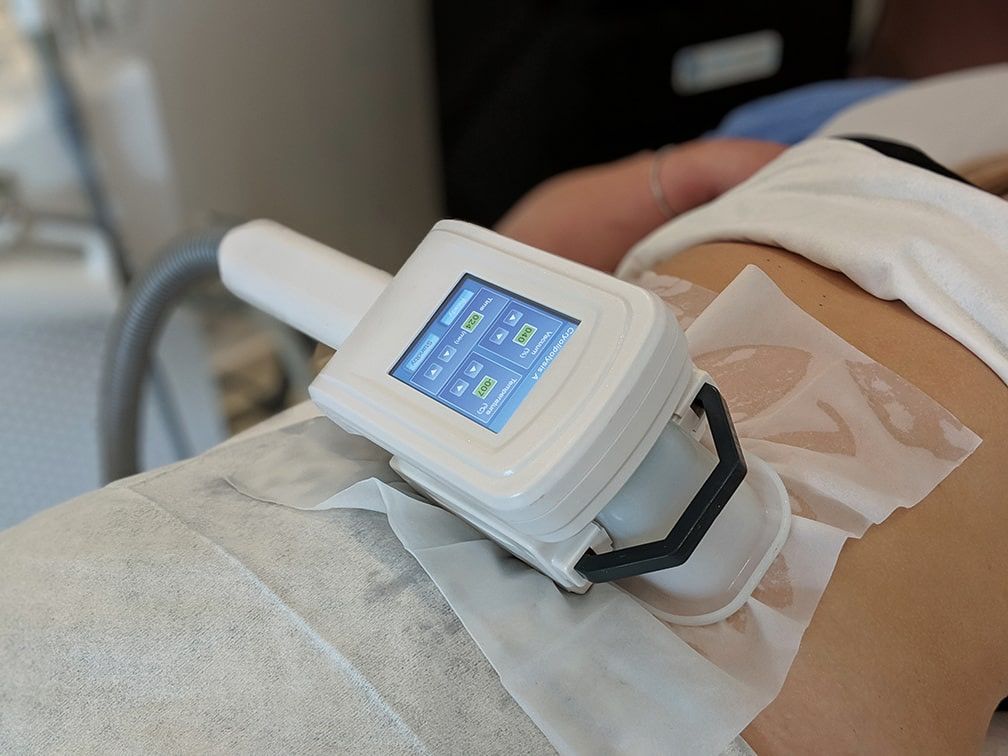Fat Freezing